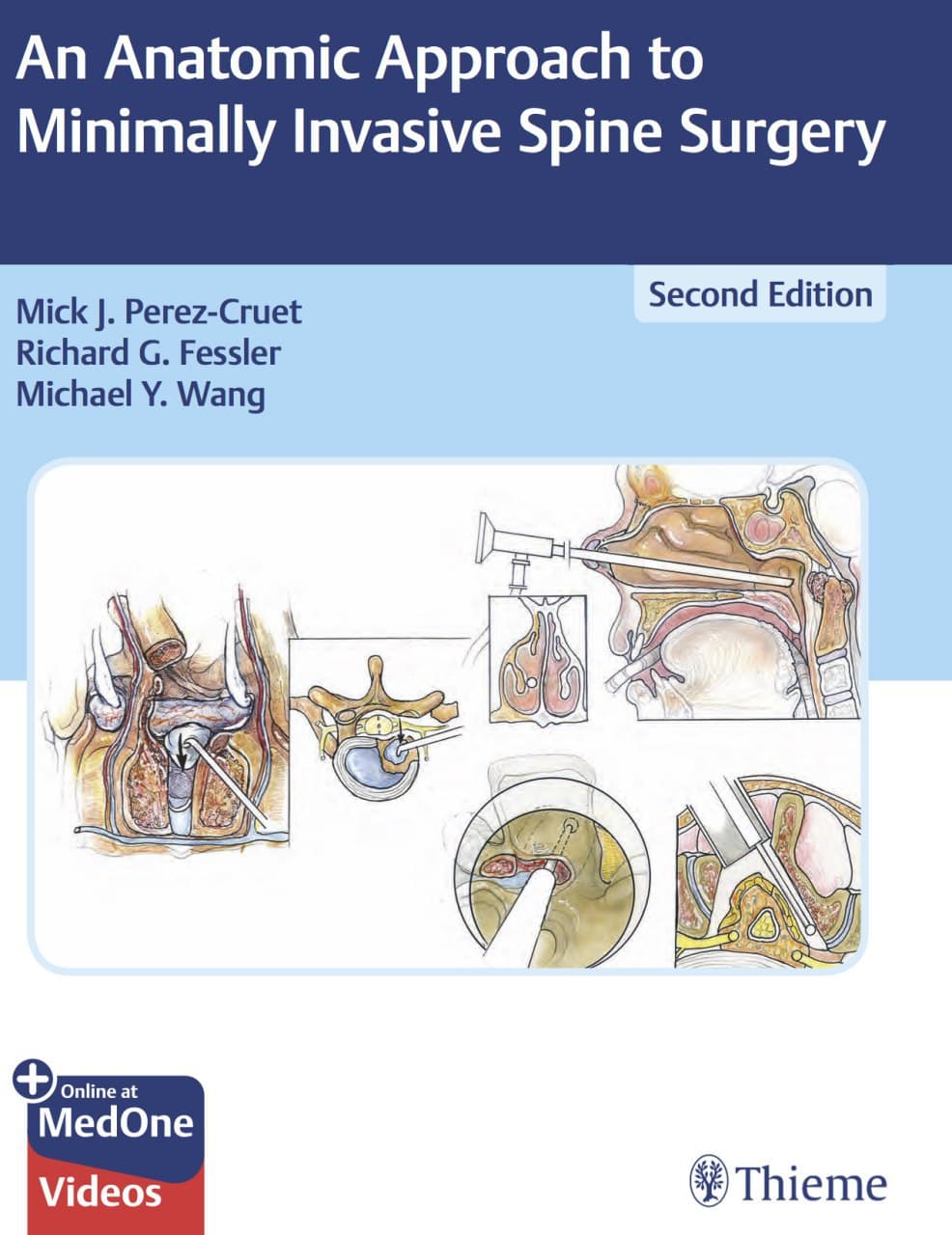 An Anatomic Approach To Minimally Invasive Spine Surgery Pdf – Medicinfor