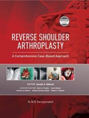 Reverse Shoulder Arthroplasty