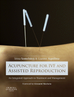 Acupuncture for IVF and Assisted Reproduction An Integrated Approach to Treatment and Management