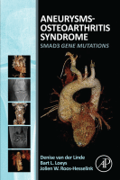 Aneurysms-Osteoarthritis Syndrome SMAD3 Gene Mutations