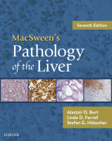 Macsween's Pathology of the Liver