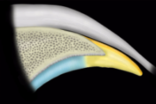 MRIonline Mri mastery series Hip 2021 cme videos