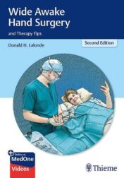 Wide Awake Hand Surgery and Therapy Tips 2nd Ed