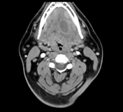 mrionline-imaging-mastery-series-pathology-of-the-oral-cavity-and-oropharynx-2020