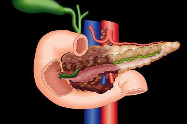 mrionline-imaging-mastery-series-pancreas-imaging-2021
