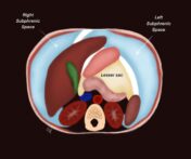 Imaging Mastery Series: Peritoneum and Mesentery