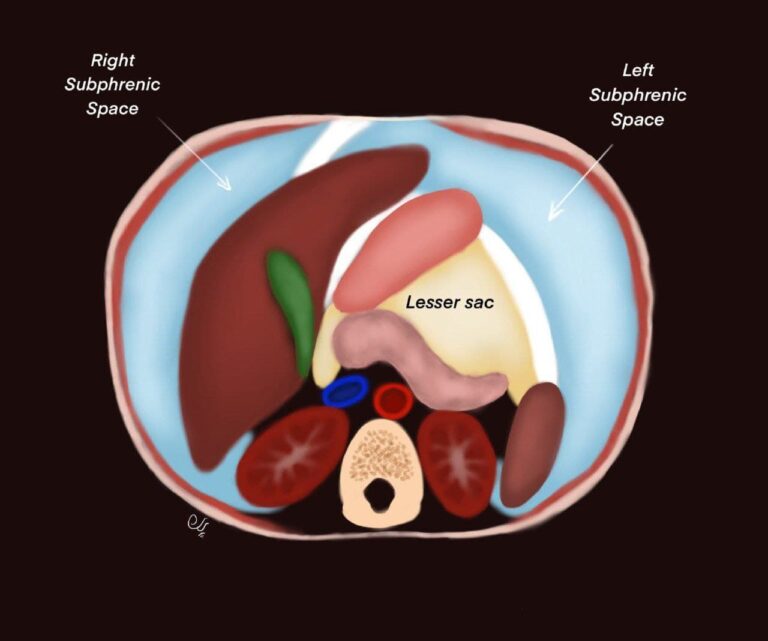 Imaging Mastery Series: Peritoneum and Mesentery