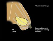 mrionline-imaging-mastery-series-regulatory-standards-of-care-in-breast-imaging-2021