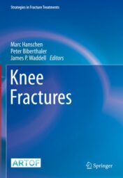 2022 Knee Fractures (Strategies in Fracture Treatments) Original PD