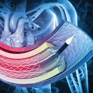 Comprehensive Review and Update of What’s New in Vascular and Endovascular Surgery 2021 (CME VIDEOS)