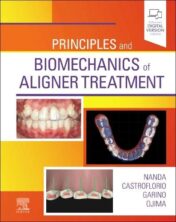 Principles and Biomechanics of Aligner Treatmen