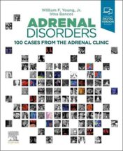 Adrenal Disorders: 100 Cases from the Adrenal Clinic