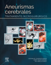 Aneurismas cerebrales: Tratamiento microquirúrgico (Original PDF