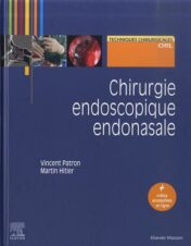 Chirurgie endoscopique endonasale