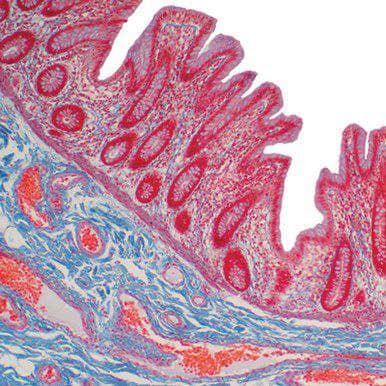 Current Topics in Gastrointestinal and Liver Pathology 2022