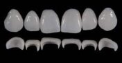 Gidedental Prosthetic Rehabilitation on Natural Teeth – Predictable, Esthetic and Systematic Steps 2020