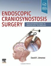 Endoscopic Craniosynostosis Surgery: An Illustrated Guide to Endoscopic Techniques