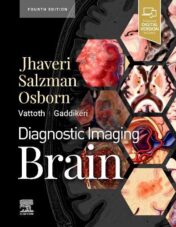 Diagnostic Imaging: Brain, 4th Edition