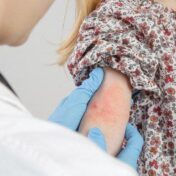 Dermatology for Primary Care 2022 CME VIDEOS