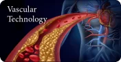 Vascular Technology Review 2022 CME VIDEOS