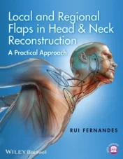 Local and Regional Flaps in Head and Neck Reconstruction: A Practical Approach (Videos+PPT