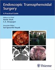 Endoscopic Transsphenoidal Surgery: A Practical Guide