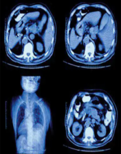 UCSF Abdominal and Thoracic Imaging 2022 (CME VIDEOS