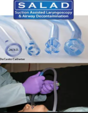 The SALAD Technique Suction-Assisted Laryngoscopy (with simultaneous) Airway Decontamination CME VIDEOS