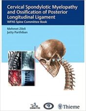 spondylotic myelopathy