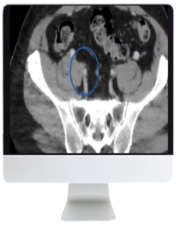 ARRS Venous Disease: Exploration of Advances, Challenges, and Future Directions 2021 videos