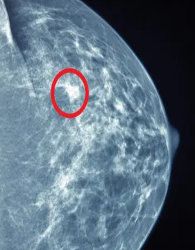 UCSF Breast Imaging 2022 CME VIDEOS