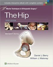 Master Techniques in Orthopaedic Surgery: The Hip 2015 Epub+Converted PDF