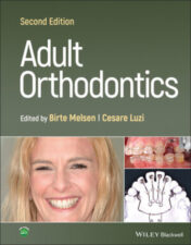 Adult Orthodontics, 2nd Edition 2022 Original PDF