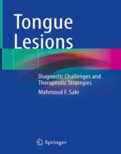Tongue Lesions: Diagnostic Challenges and Therapeutic Strategies 2022 epub+converted pdf