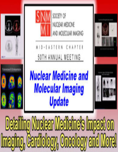 Nuclear Medicine and Molecular Imaging Update 2022 (CME VIDEOS)