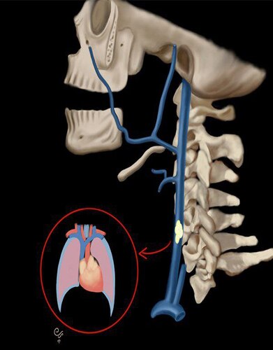 MRIOnline Emergency Series: Emergency Neuroimaging: Head, Neck & Spine 2021 CME VIDEOS