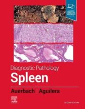 Diagnostic Pathology: Spleen, 2nd Edition (Original PDF