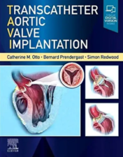Transcatheter Aortic Valve Implantation 2022 Original PDF
