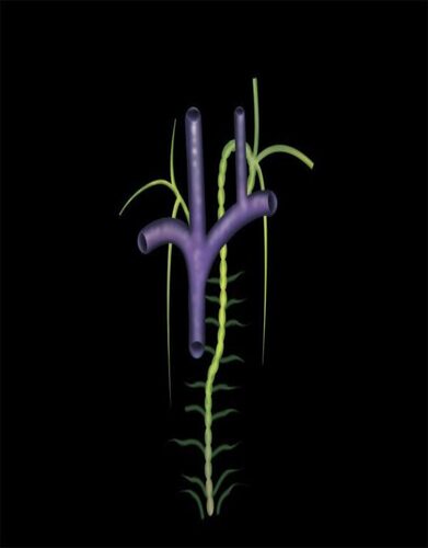 MRIOnline Mastery Series: Brachial Plexus 2022 (CME VIDEOS)