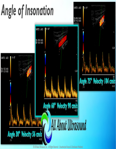 Mastering Doppler Principles and Hemodynamics- AllAboutUltrasound (Complete HTML)