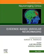 Evidence-Based Vascular Neuroimaging, An Issue of Neuroimaging Clinics of North America (Volume 31-2) (The Clinics: Radiology, Volume 31-2) 2021 Original PDF