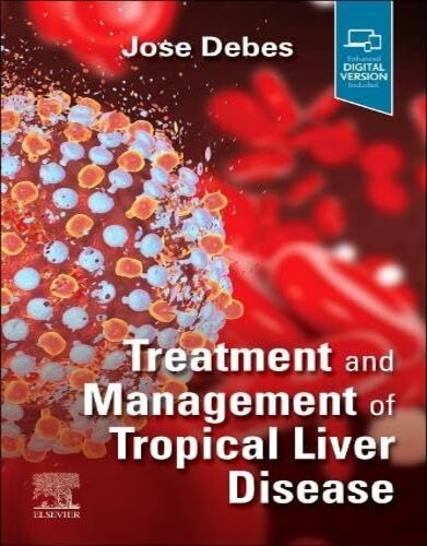 Treatment and Management of Tropical Liver Disease (ePub+Converted PDF)