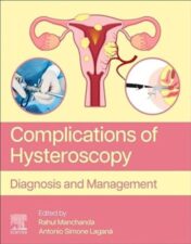 Complications of Hysteroscopy: Diagnosis and Management.2023 Original PDF