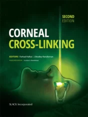Corneal Cross-Linking, 2nd Edition.2017 Original PDF