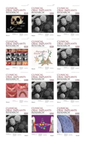 Clinical Oral Implants Research 2022 Full Archives True PDF