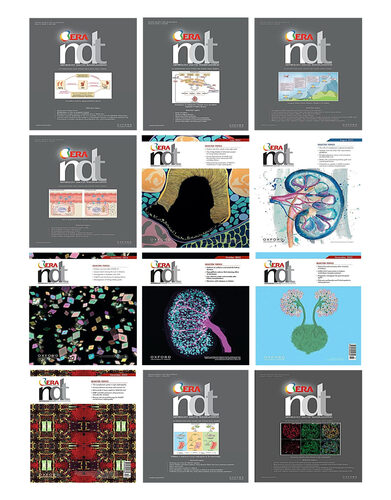 Nephrology Dialysis Transplantation 2023 Full Archives True PDF