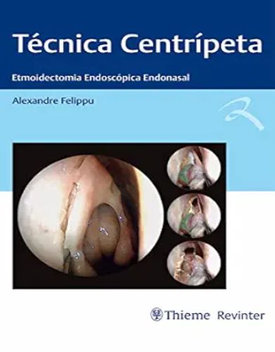 Técnica Centrípeta: Etmoidectomia Endoscópica Endonasal (Portuguese Edition) 2022 epub and converted pdf