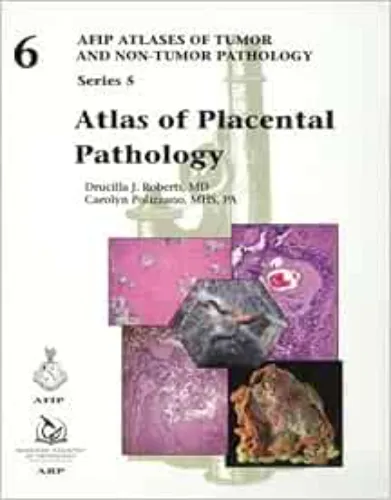 Atlas Of Placental Pathology (AFIP Atlas Of Tumor And Non-Tumor Pathology, Series 5, Volume 6) .2021 Original PDF