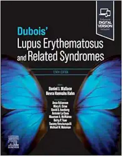 Dubois’ Lupus Erythematosus And Related Syndromes, 10th Edition (True PDF)