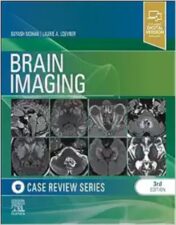 Brain Imaging: Case Review Series, 3rd Edition,2024 Original PDF